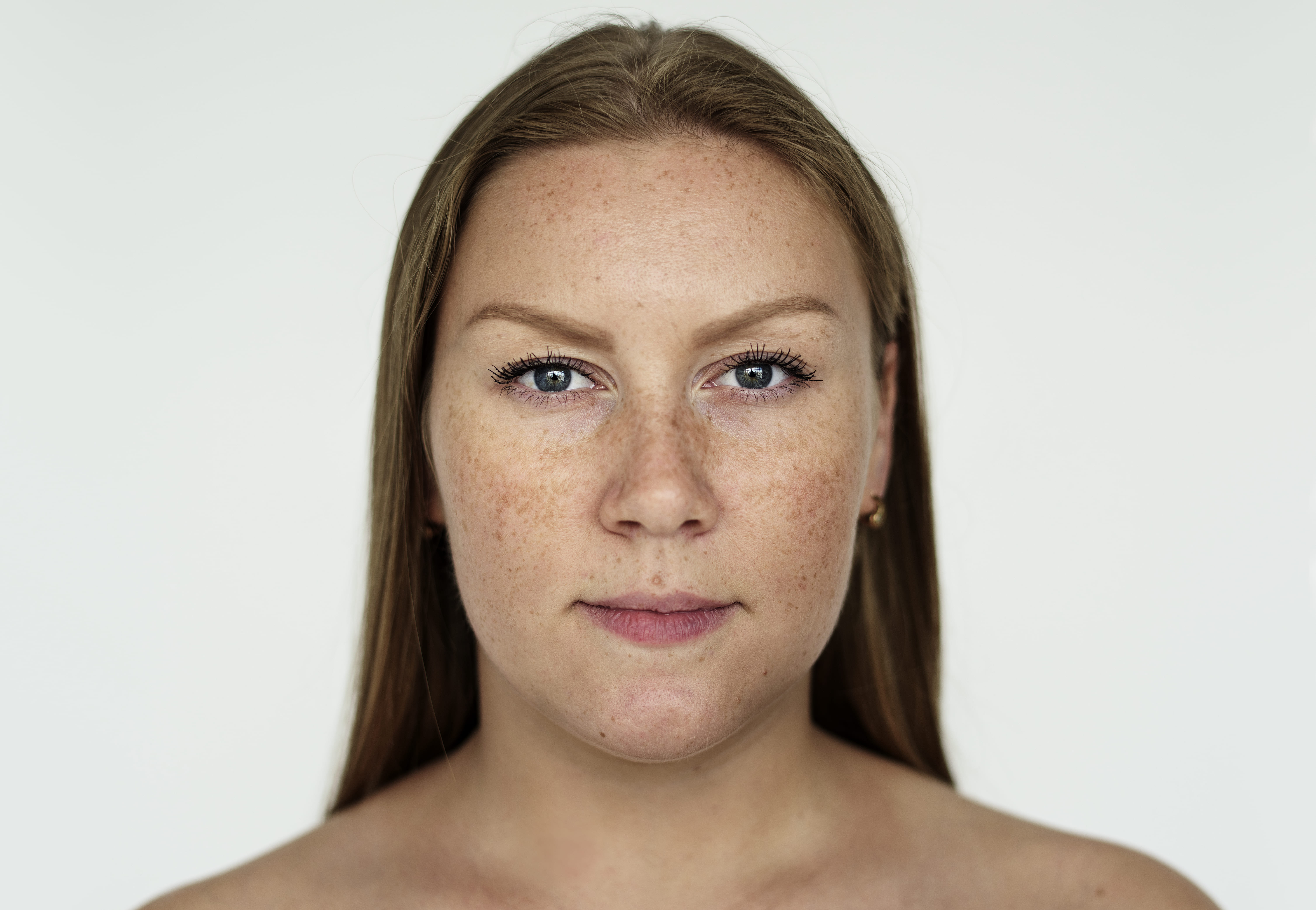 Rosto com melasma
